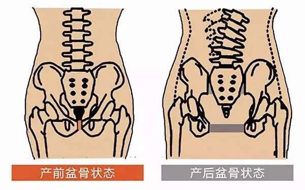 产前产后骨盆状态