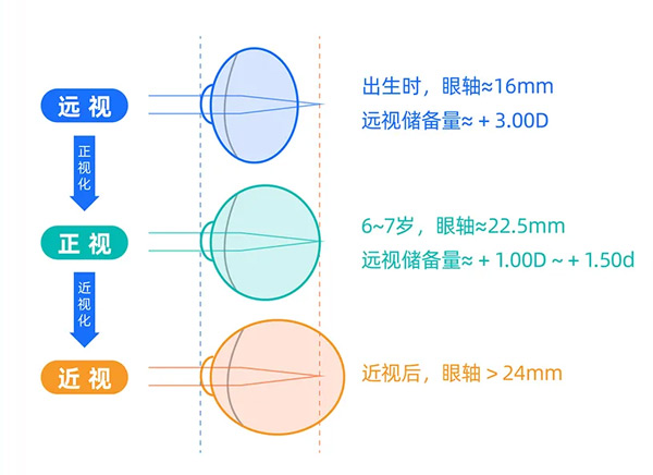 0-6岁儿童眼保健有多重要？