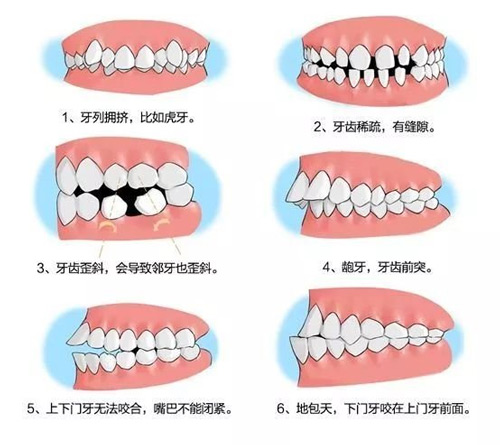 儿童牙齿矫正的黄金时机是什么时候？