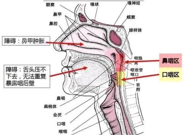 疾控专家告诉你核酸检测为什么要采口鼻不能采耳？