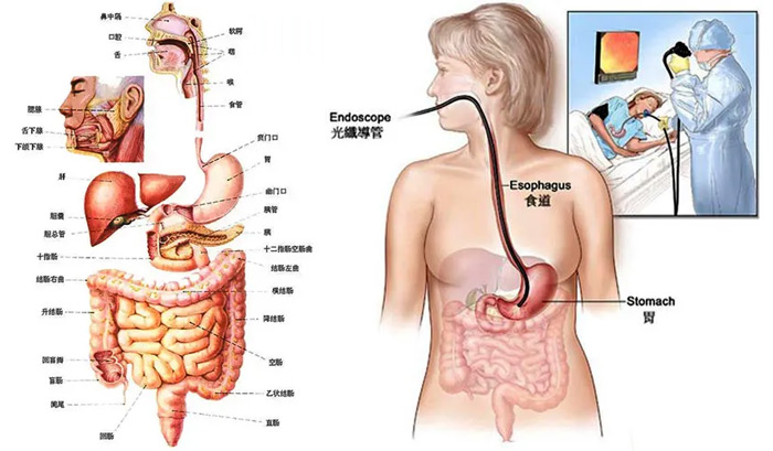 无痛胃镜有点和检查前后注意事项