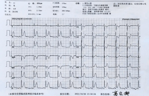 异乡客突发心梗 阳城医院把命救