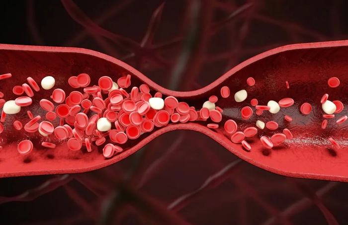 听说过血管也有“年龄”吗？如何检测？