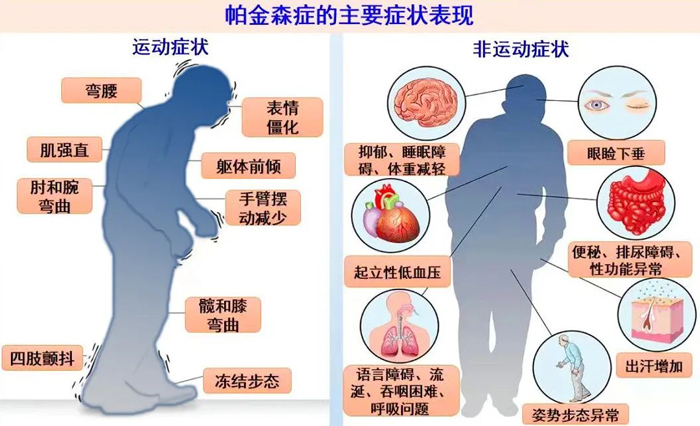 别害“帕”，神经外科团队一招帮七旬老人逆转“颤抖命运”