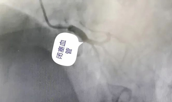 紧急！时间与死神的较量，年轻人更应该警惕这病……