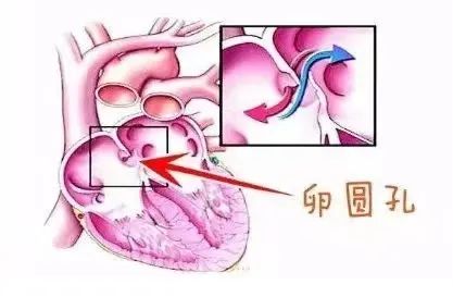 警惕！多年查不出原因的头痛症，建议多做这一项检查……