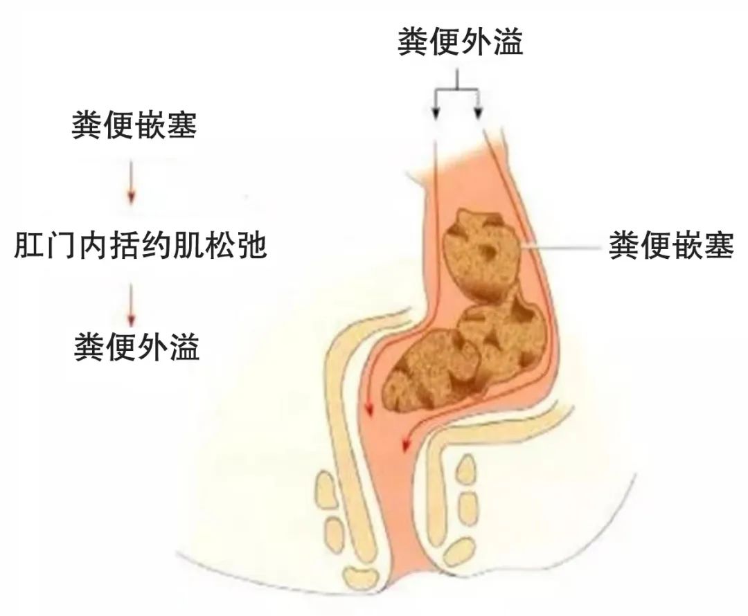 关于“菊花”的难言之隐....