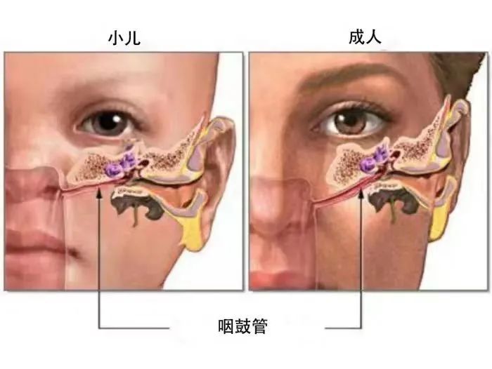 孩子感冒后易发这病，90%的家长都会忽视这些症状！