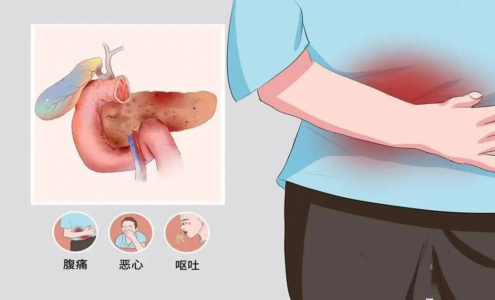 年轻人的致命习惯，让她差点住进ICU......