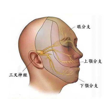 一根针，20分钟，为他解决困扰1年之久的“天下第一痛”！