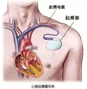 当心脏停摆，谁来拯救？是命运的安排，还是奇迹的降临？