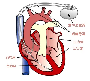 当心脏停摆，谁来拯救？是命运的安排，还是奇迹的降临？